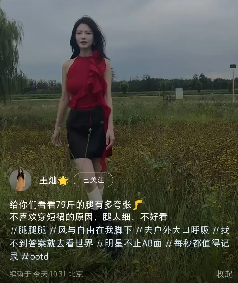 杜淳老婆暴瘦不足80斤，穿短裙瘦成“闪电”，长腿细得像麻杆封面图