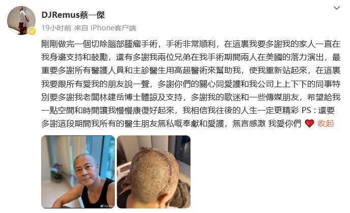 “草蜢”蔡一杰透露刚做完脑瘤手术：相信往后的人生一定更精彩封面图